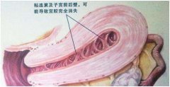 残角子宫能够做试管吗？